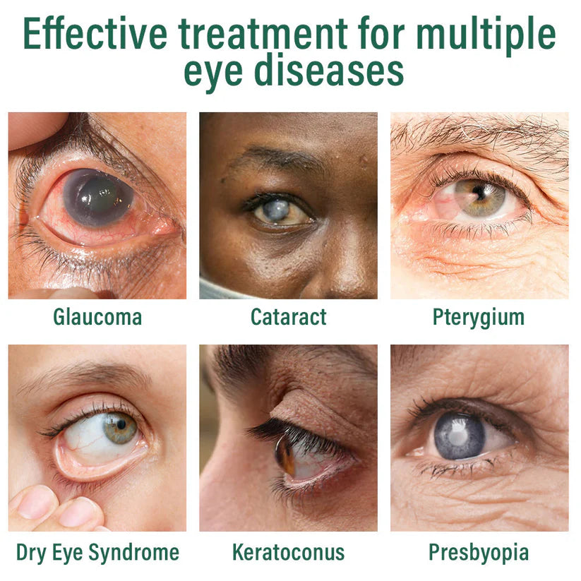 ✅LOVILDS® Nano Eye Drops Serum 👩⚕️Suitable for presbyopia, dry eye syndrome, glaucoma, and cataracts