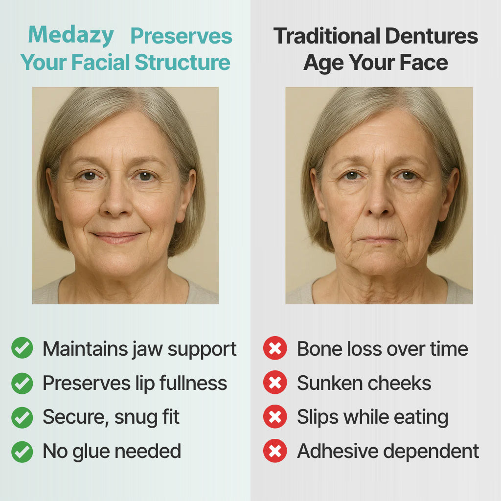 Medazy Custom-Fit Full Functional Dentures