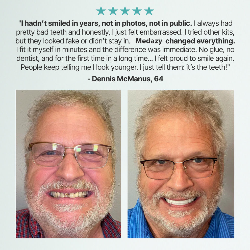 Medazy Custom-Fit Full Functional Dentures