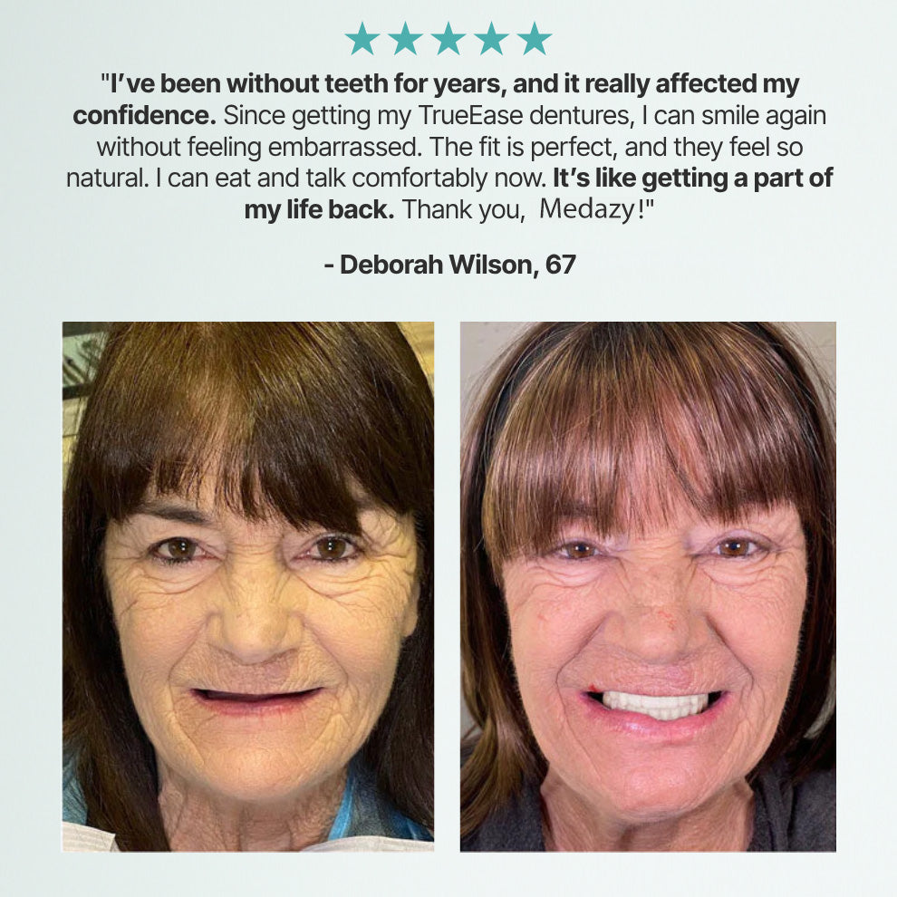 Medazy Custom-Fit Full Functional Dentures